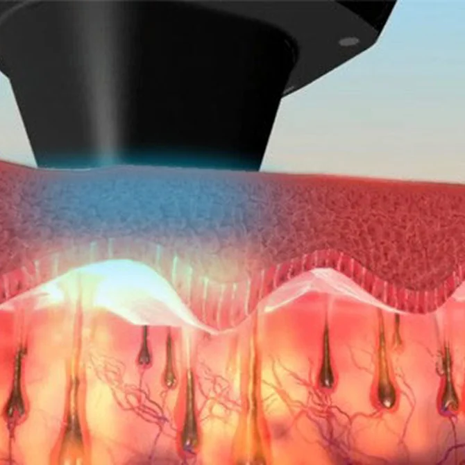 첨단 쿨링 시스템 기술