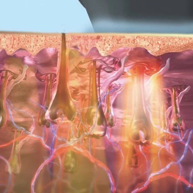 특화 에너지 조절 시스템