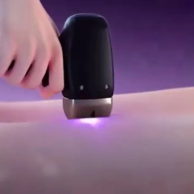 최소 통증 조절 시스템