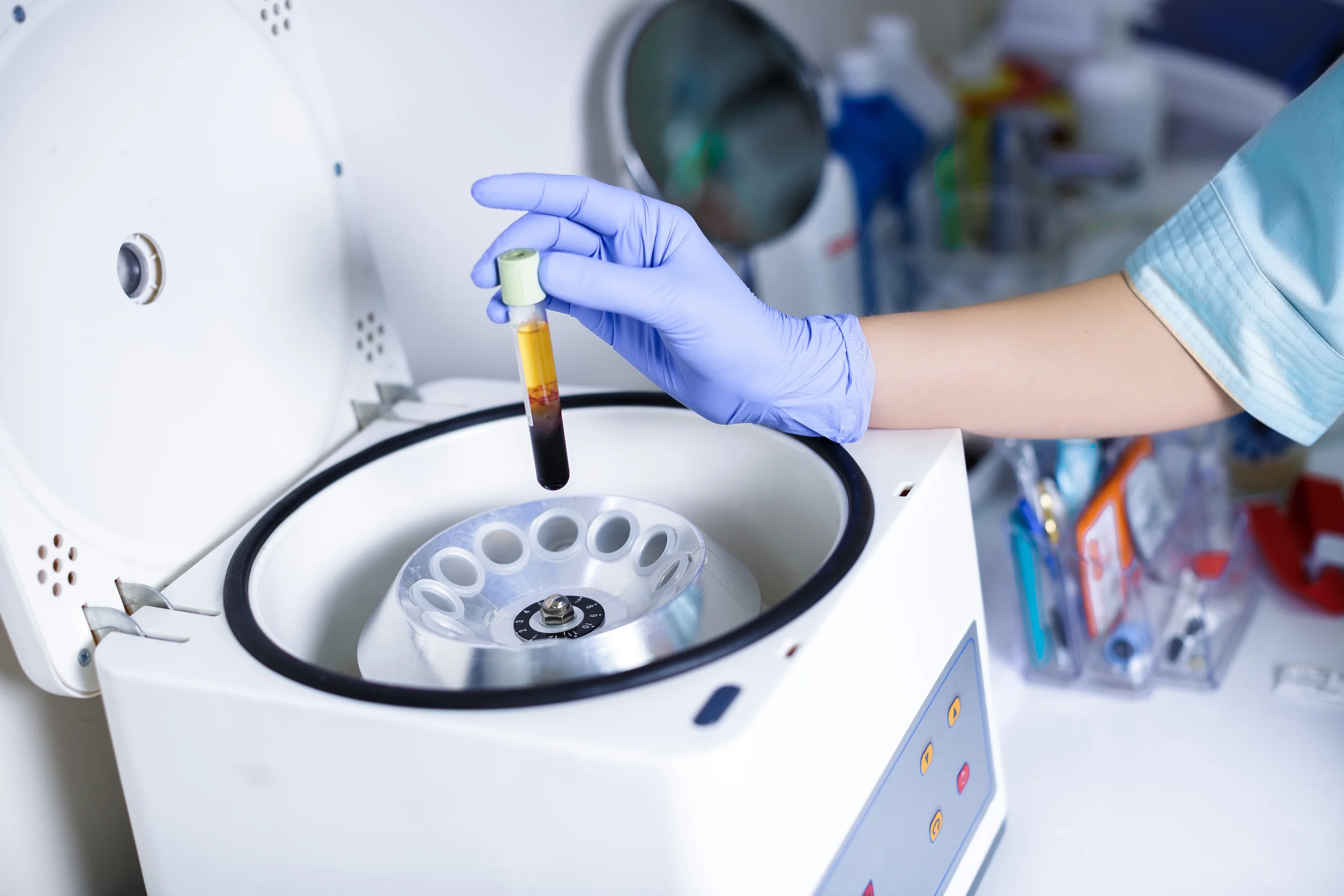 원심분리 비교 비주얼 이미지