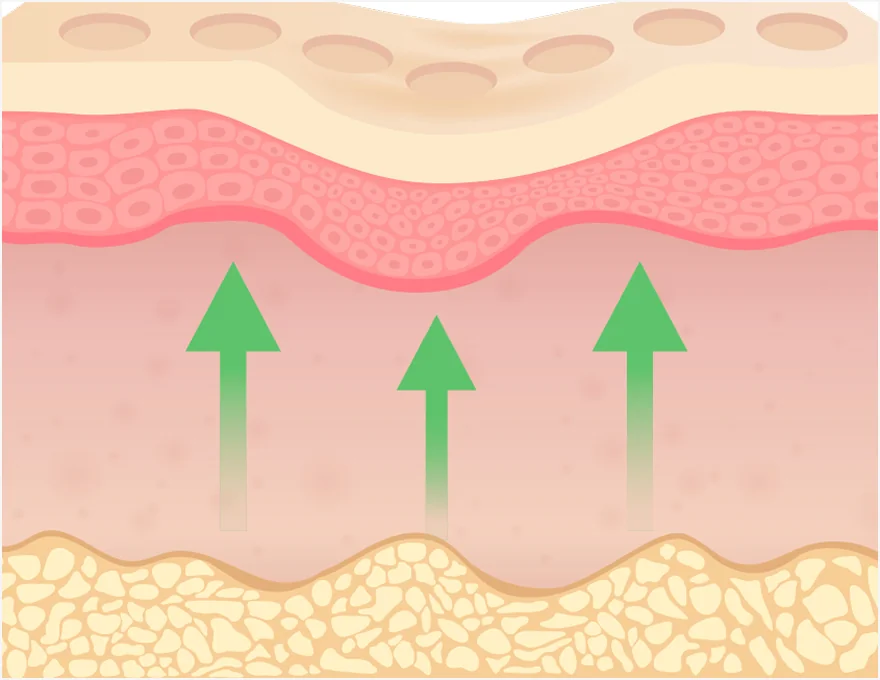 쥬베룩 시술 2단계 성분 분해