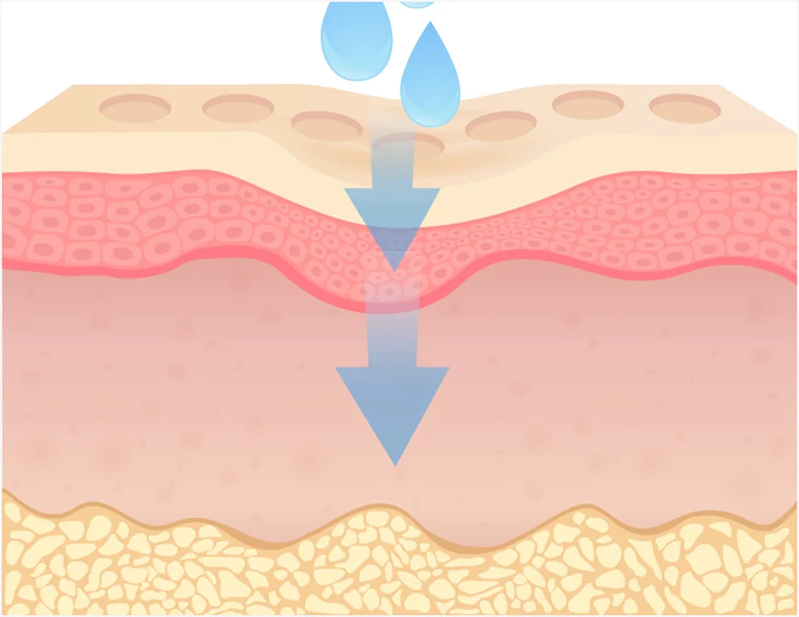 레티젠 콜라겐 직접 충전