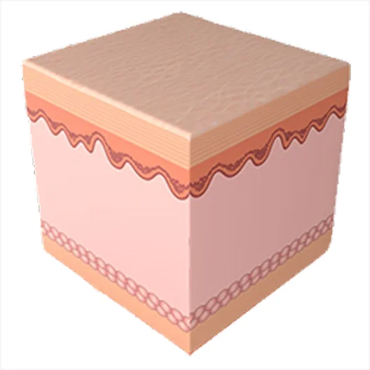 미라젯 시술 과정 5