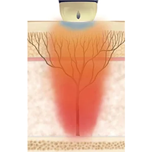 STACK 모드 - 강력한 리프팅, 타이트닝, 브라이트닝 효과
