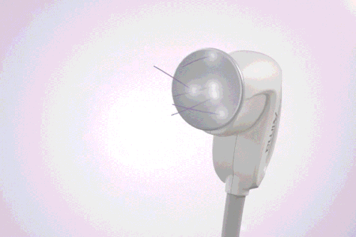 3D 입체 초음파 시스템