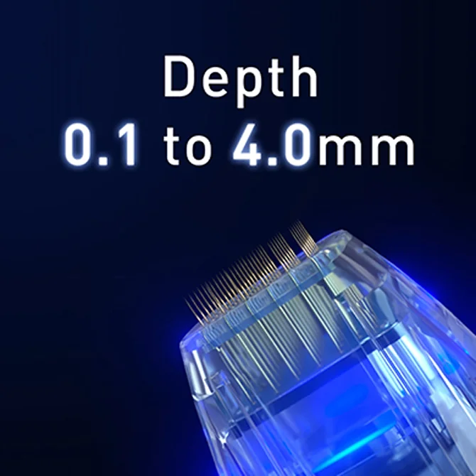 아이버츄 RF 0.1mm-4mm 깊이 조절 시스템