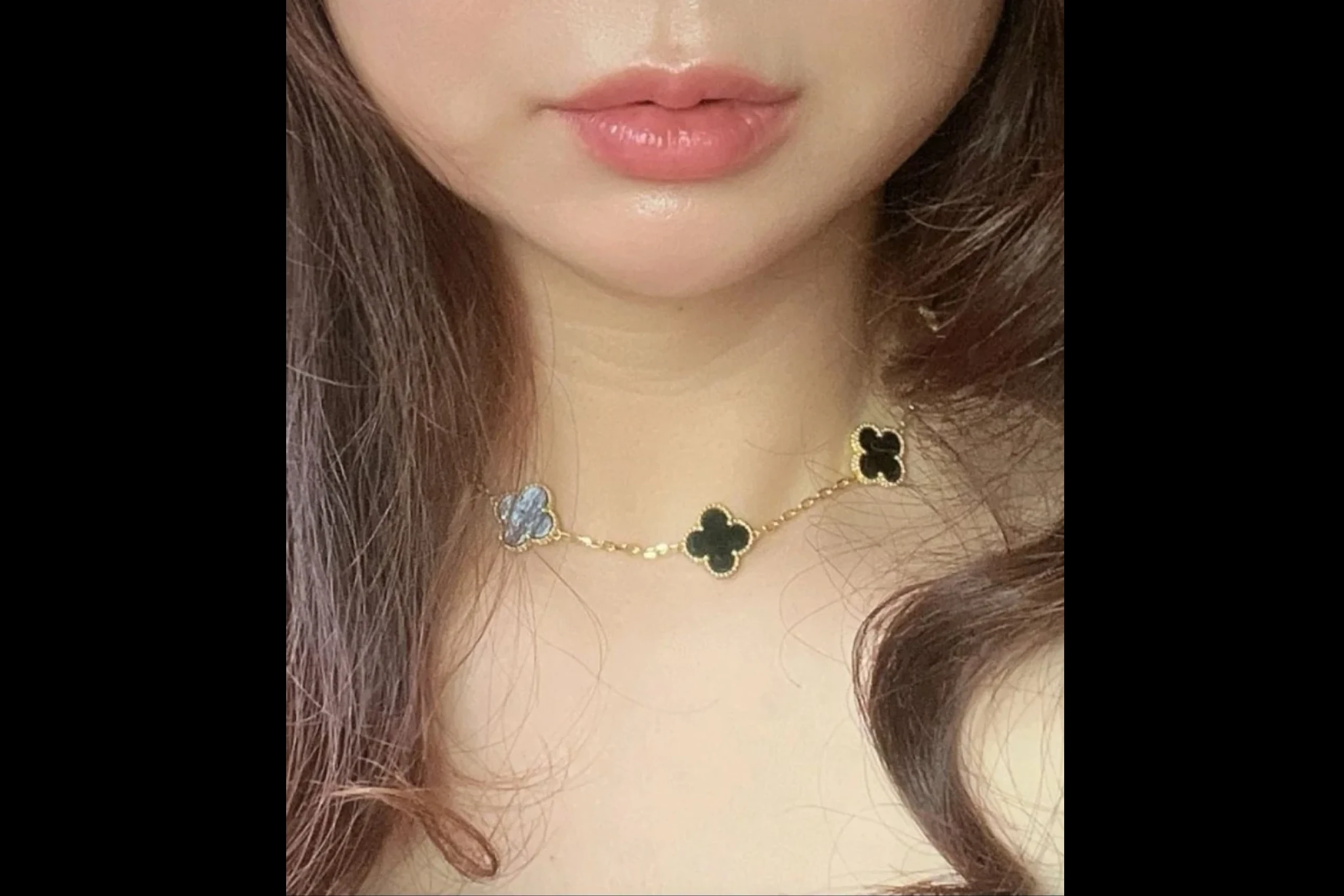 지우개의원 입술 필러 전 상태